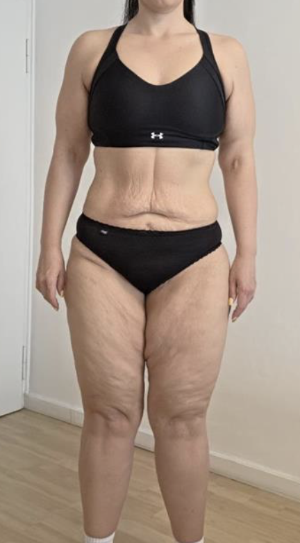 Sanela sprijeda, 3 mjeseca
